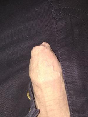manche