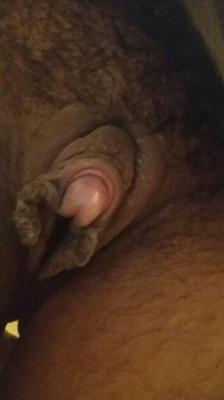 黒いクリトリスが白いペニスよりも大きくなりました