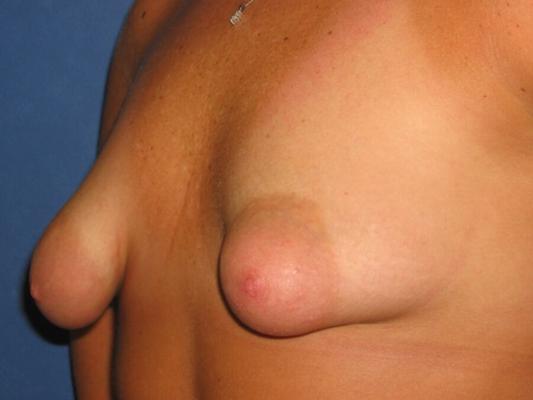 Go topless for us sweety, show my friends your boobs