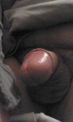 mon gros gland