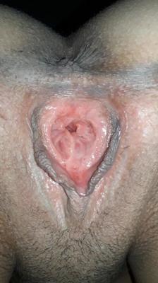 熱い