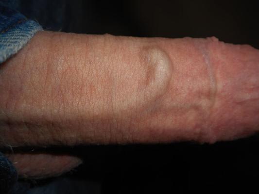 Veiny