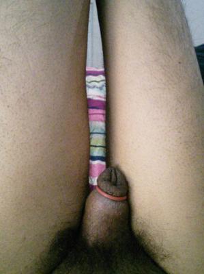 Foreskin Nudist