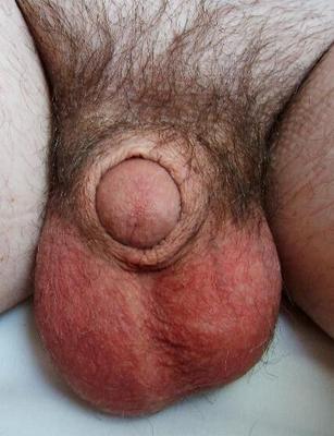 Mr. smalldick UK.