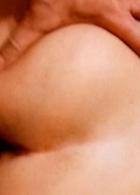 H anal