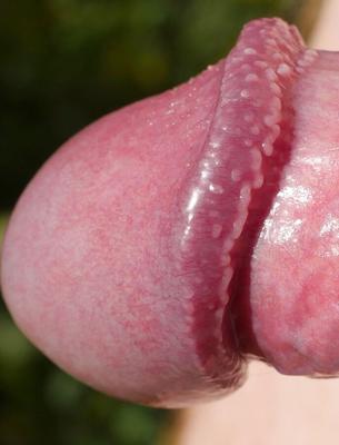 Bite à l'extérieur