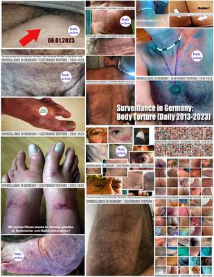 Torture électronique en Allemagne