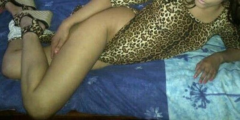 I want a tribute,  iv grow hair on my hump