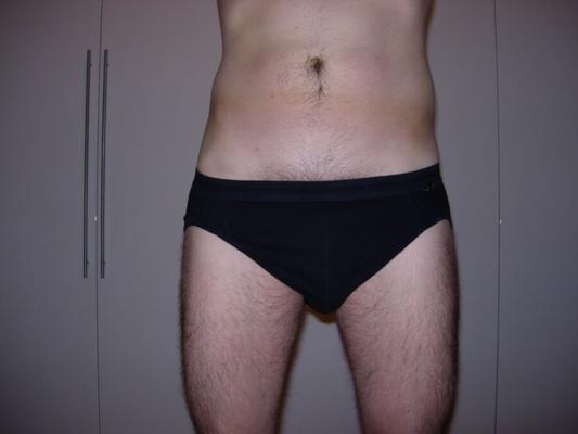 Slip Strip