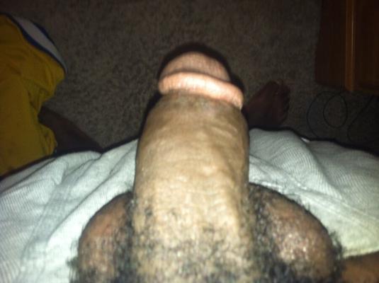 My Log