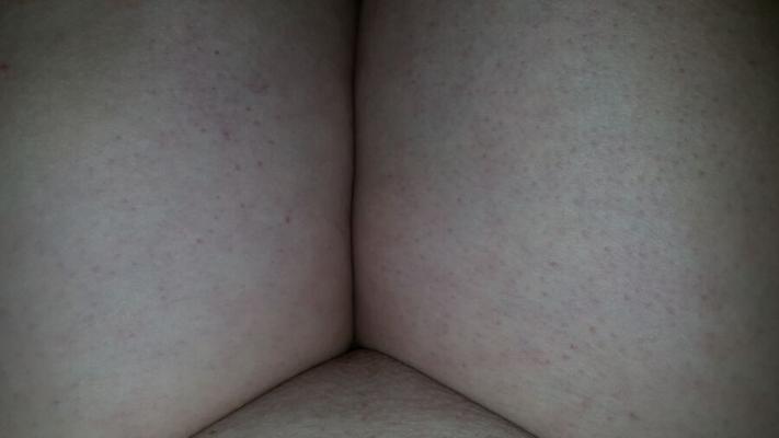 Misc. Photos