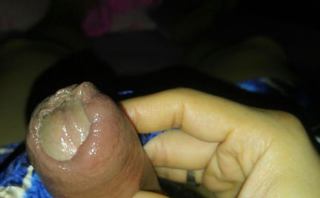 kontol