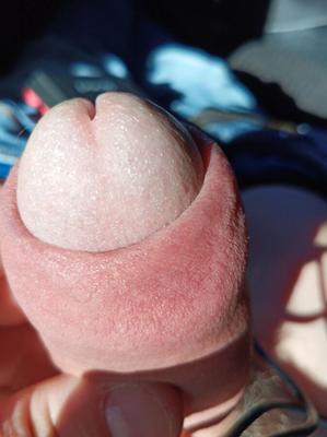 ME ICH COCK SCHWANZ HORNY GEIL UGLY EICHEL COCKHEAD