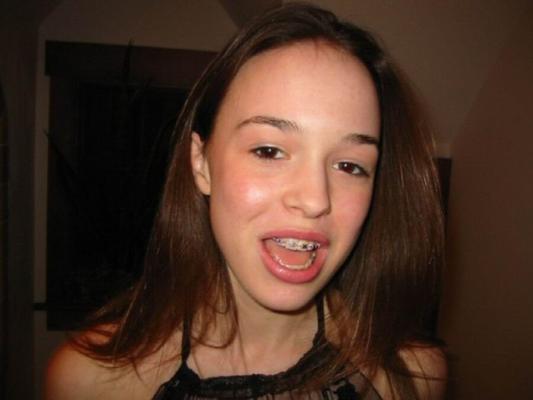 Brunette Braces Lingerie Teeniebopper Party(nn)