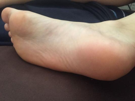 Les pieds de GF