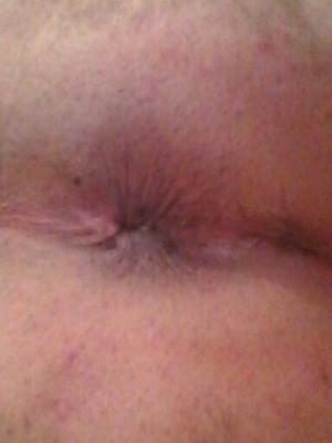 My shaved asshole