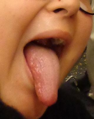 bouche ouverte