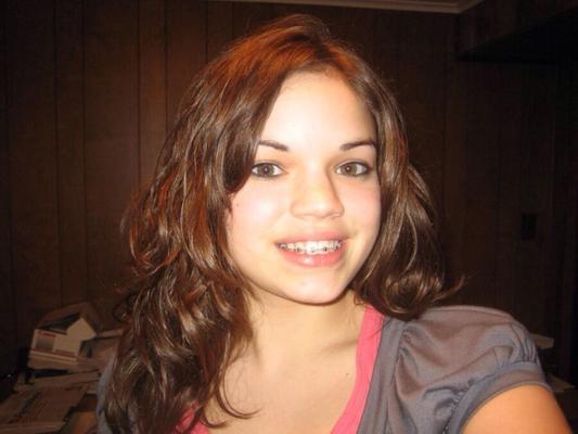 Pretty faces with braces