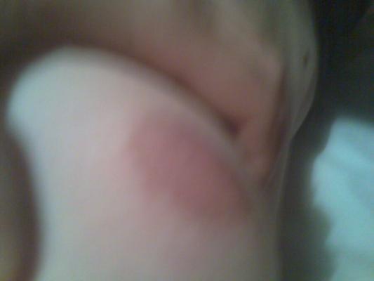 My nipples