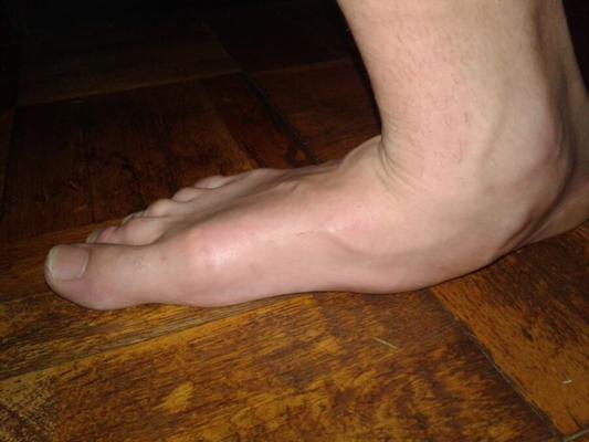My feet