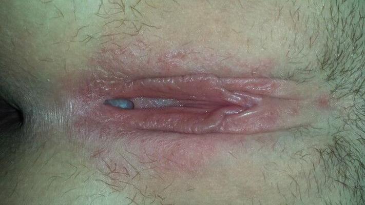 Médico amateur real