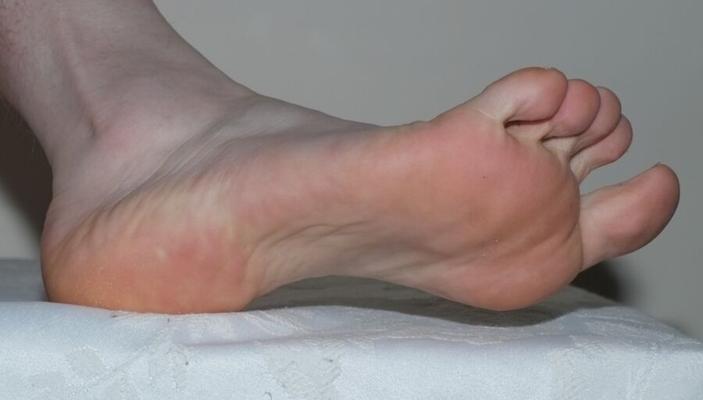 Pies