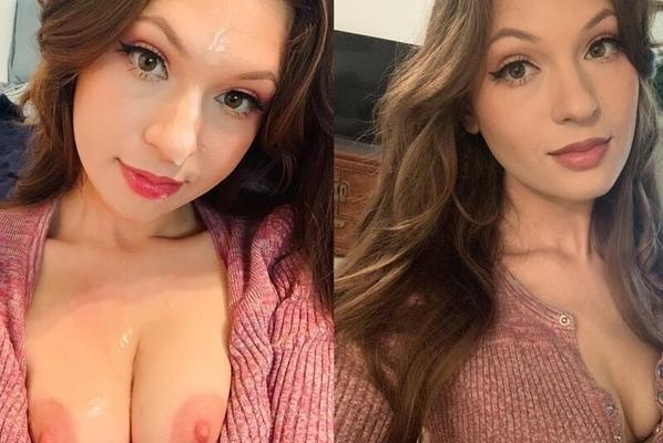 Before and After Facials 23