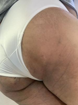 Missykoks en culotte blanche