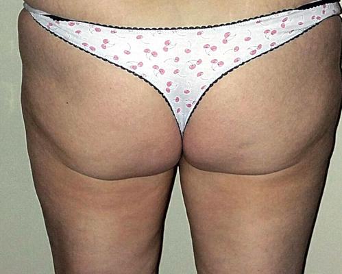 近所のおばあちゃんがTバックを試着して惨めに失敗