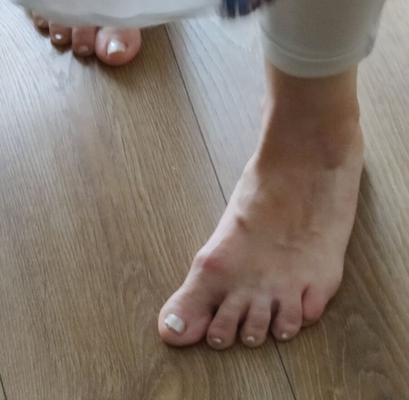Ugly feet my mother in law