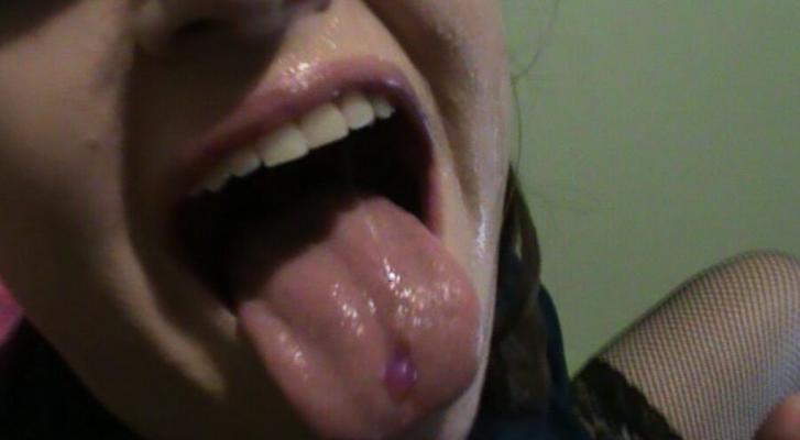 in the face!
