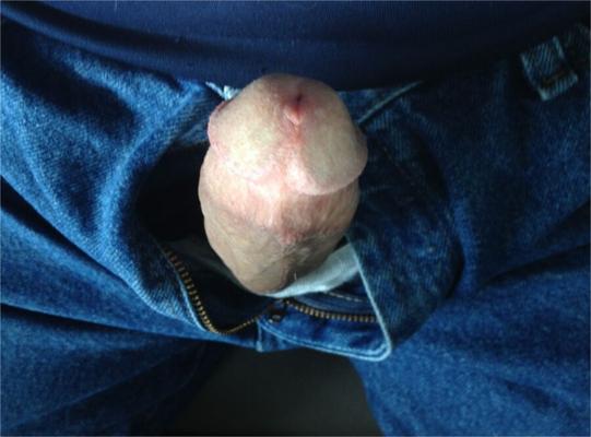 Jacking de voiture