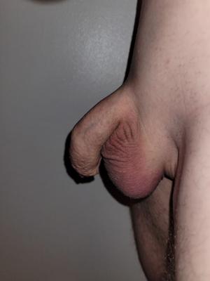 Dicklette