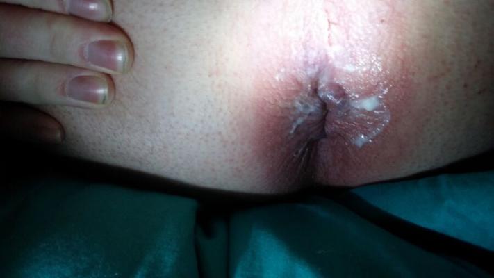 Anus pictures